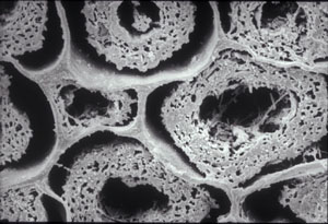 Scanning electron micrographs of sections from the ship hull showing extensive bacterial degradation of the wood cells.