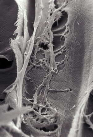 Scanning electron micrograph showing the hypha of a white rot fungus in the cell lumen of a wood cell