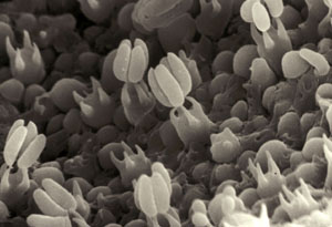 Scanning electron micrograph showing basidia and basidiospores of wood decay fungus