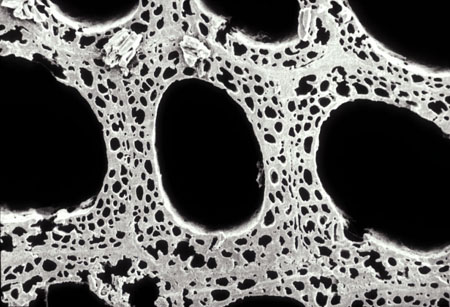 Scanning electron micrograph of a section from the decayed wood showing a soft rot attack.