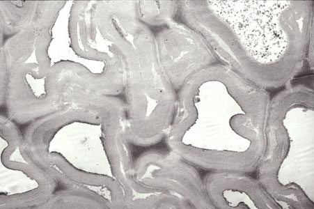 Transmission electron micrograph of a section from the Scribe of Mitre Statue showing severely degraded cell walls caused by a brown rot fungus
